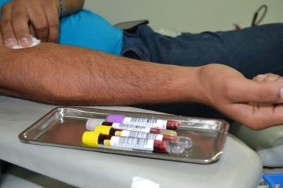 Hemose abre nesta quinta, 13, e no sábado, 15, em horários diferenciados (Foto: Arquivo/SES/SE)