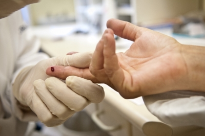 Anvisa registra primeiro teste de farmácia para detecção do HIV (Foto: Arquivo/Agência Brasil)