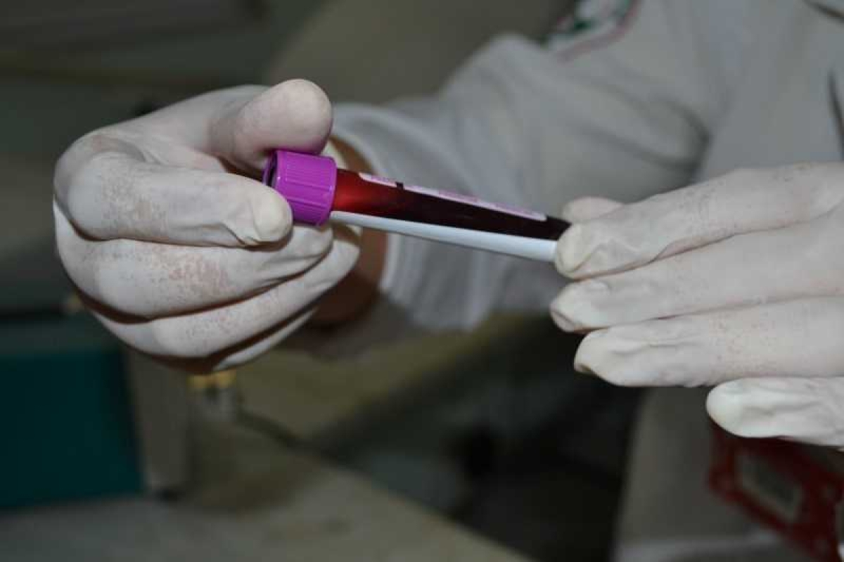 Hemocentro realiza mais de 6 mil novos cadastros de medula óssea (Foto: SES/SE)