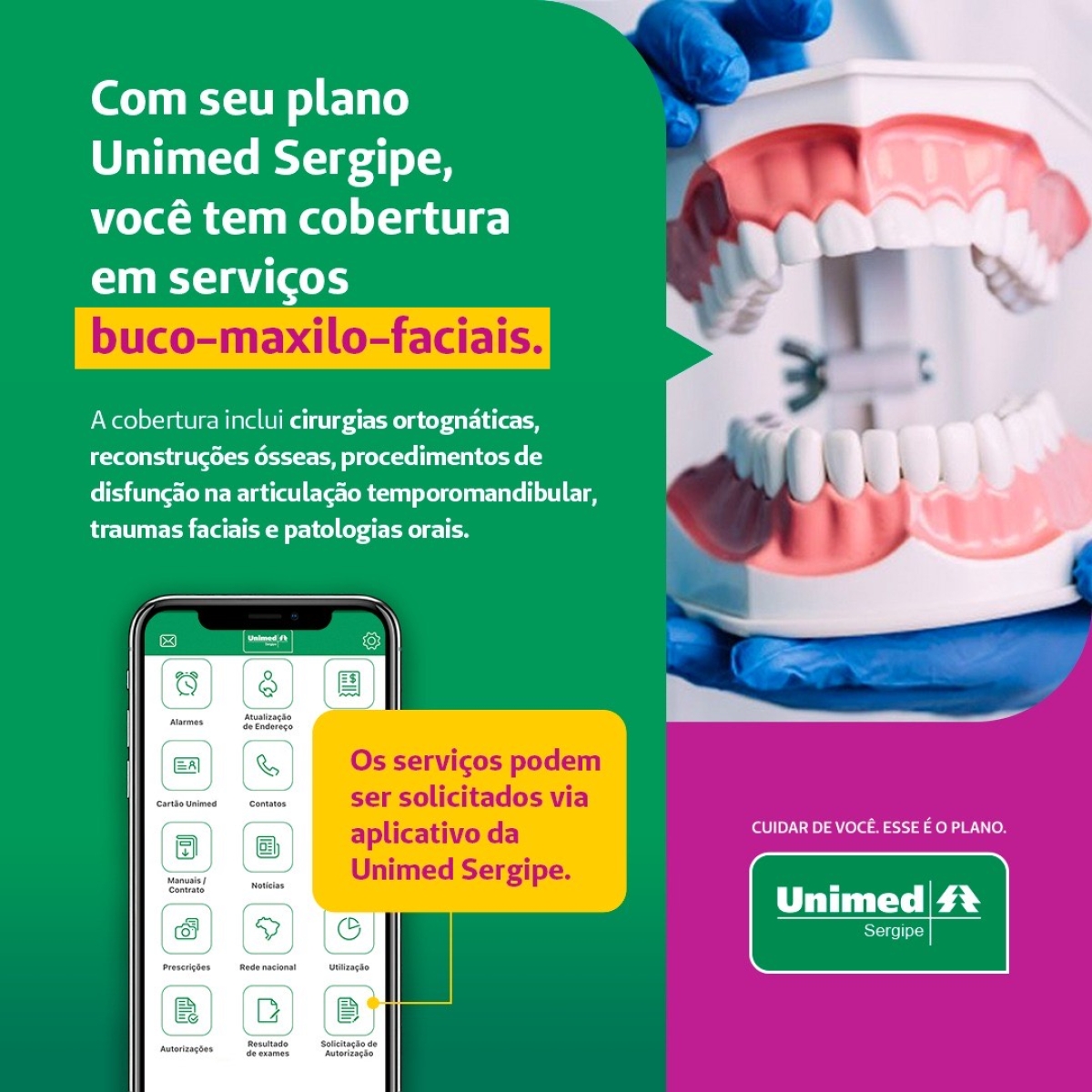 Unimed Sergipe: cirurgias buco-maxilo-facial têm cobertura de planos de saúde - Imagem: Ascom Unimed/SE