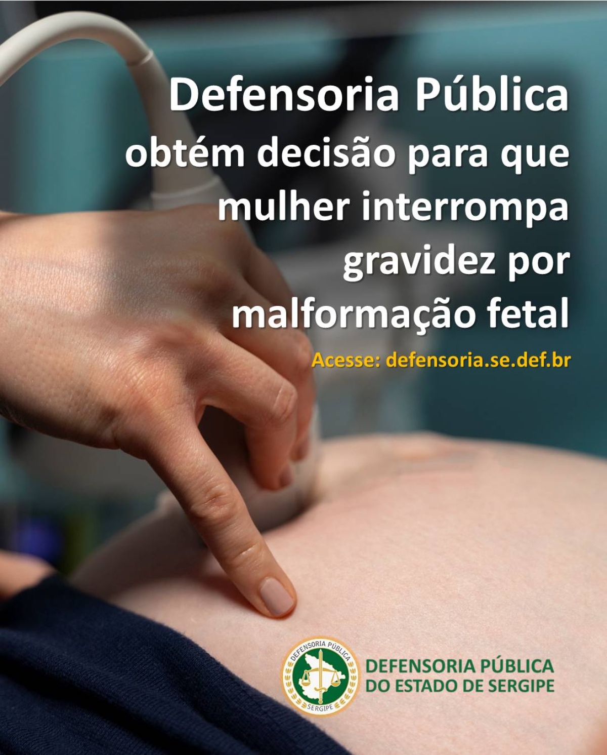 Defensoria Pública obtém decisão para que mulher interrompa gravidez por malformação fetal - Imagem: DPE Sergipe