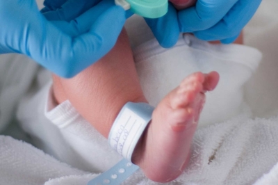 Icterícia: cuidados com recém-nascidos podem evitar a doença (Foto: Arquivo/SES/SE)