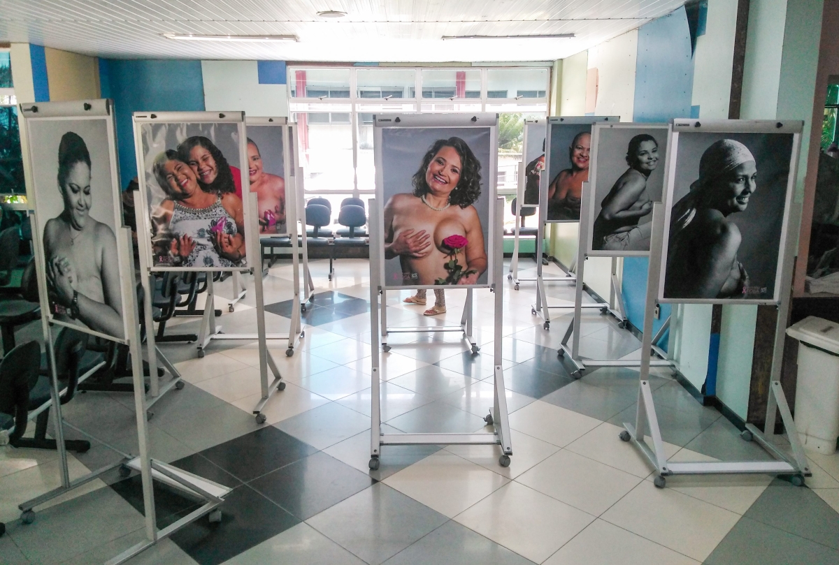 Exposição que revela beleza de mulheres com câncer será aberta no Huse (Foto: SES/SE)