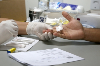 Teste para diagnóstico pode ser feito de forma rápida (Foto: Sergio Silva/PMA)