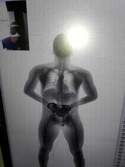 Interno é flagrado com material ilícito após voltar de audiência (Foto: Sejuc/SE)