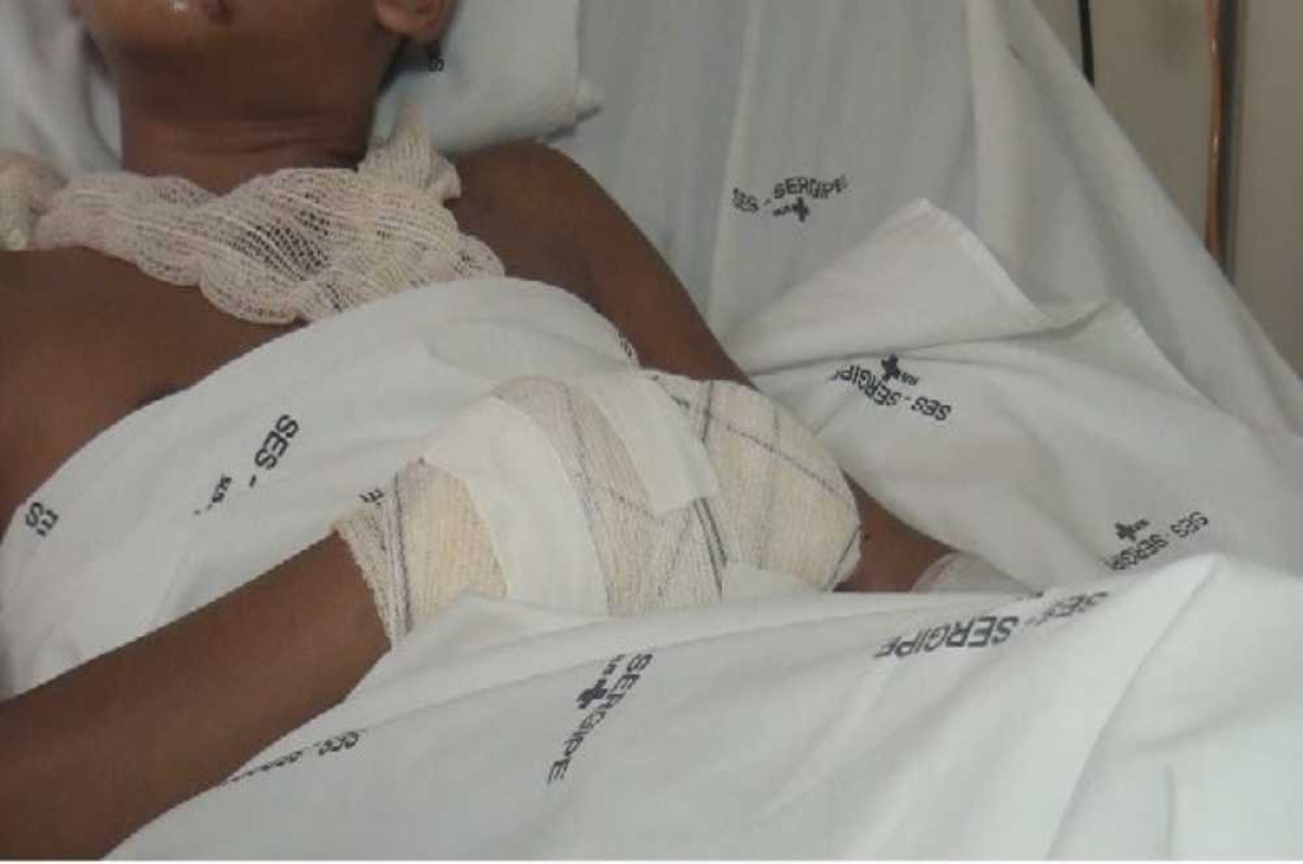 Acidentes do tipo se tornam comum nesta época (Foto: Portal Infonet)