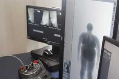 A compra e instalação do aparelho é um investimento da ordem de R$ 2.824 milhões onde foram adquiridos quatro novos aparelhos de body scan (Foto: Sejuc/SE)