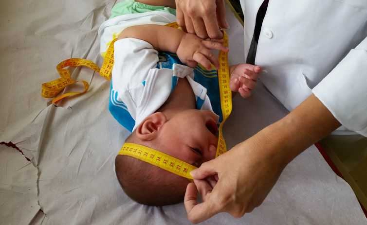 Bebê com microcefalia (Foto: Sumaia Villela/ Agência Brasil)