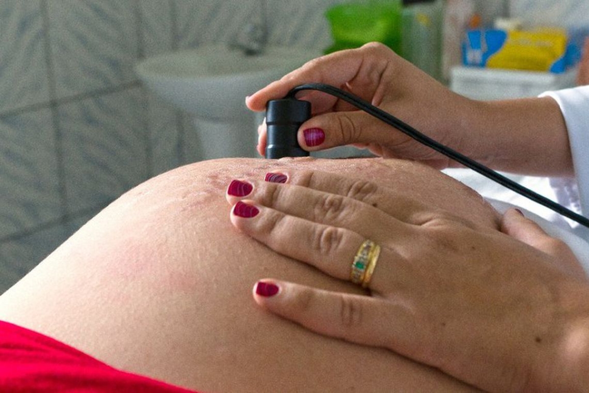 Anvisa emite alerta sobre uso de ondansetrona por grávidas (Foto: Ana Nascimento/ MDS/ Portal Brasil)