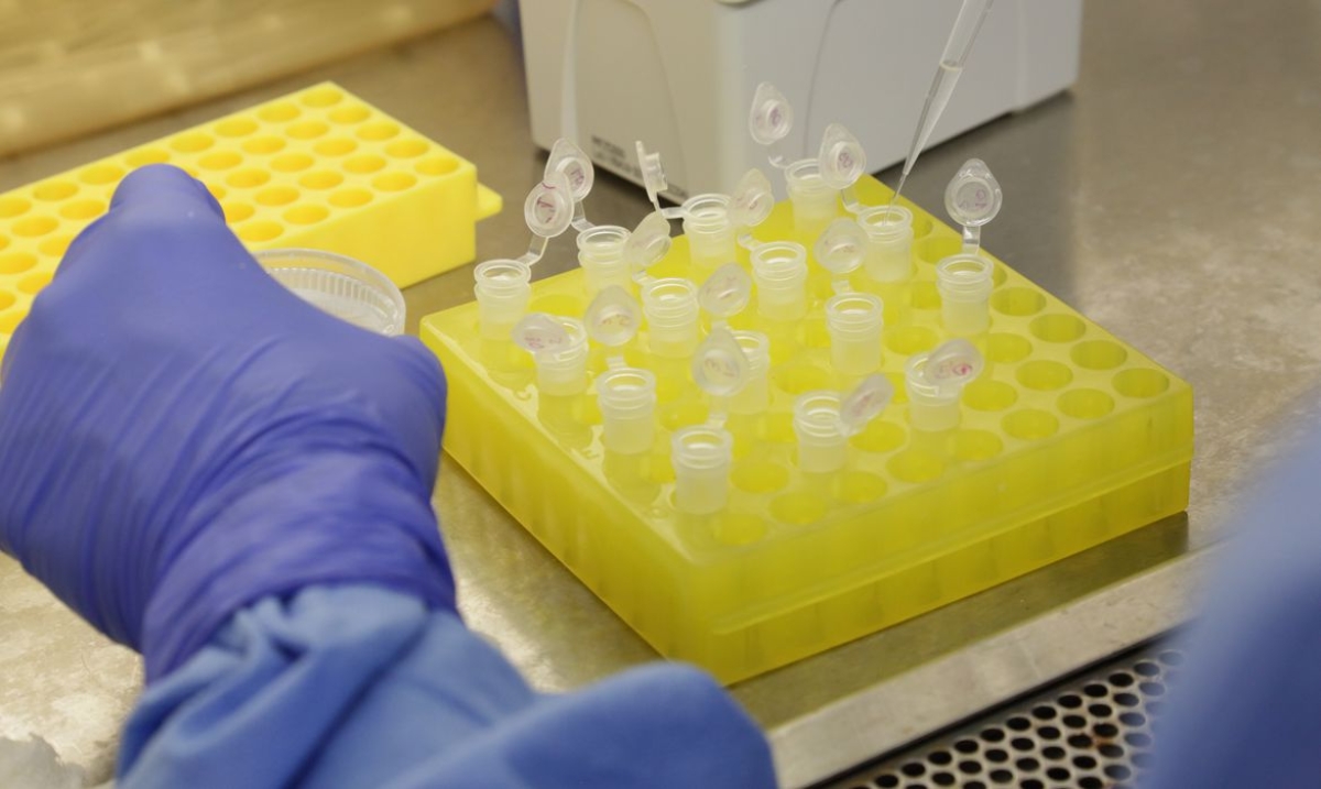 Planos de saúde terão de cobrir exames para novo coronavírus (Foto: Divulgação/ Josué Damacena/ IOC/Fiocruz)