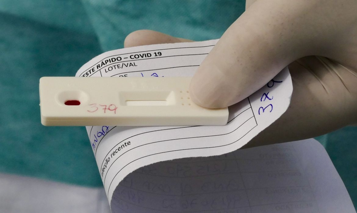 Saiba como fazer o teste diagnóstico de covid-19 pelo plano de saúde (Foto: Leopoldo Silva/ Agência Senado)