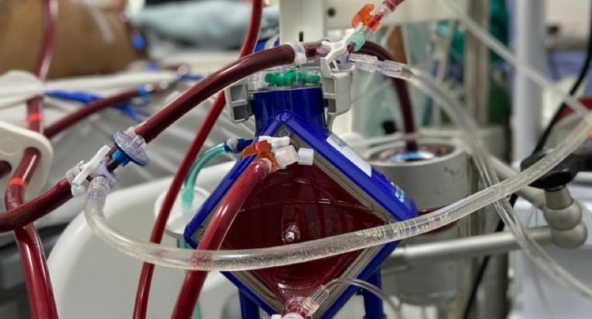 ECMO: tratamento utiliza equipe multidisciplinar (Foto: Assessoria de Imprensa Unit)