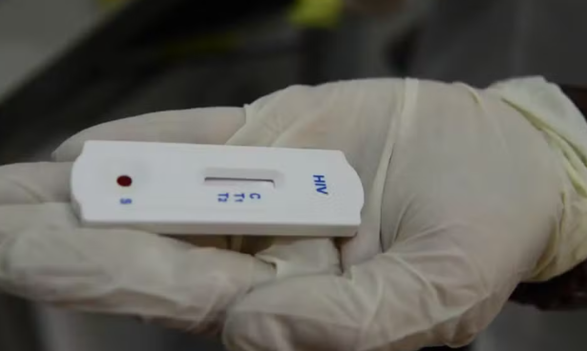 Teste de HIV - Foto: Rovena Rosa/Agência Brasil
