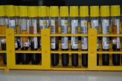 Funcionamento do servi�o de doa��o de sangue aos s�bados tem altera��o em julho (Foto: SES/SE)