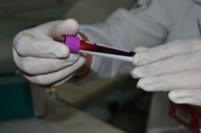 Durante o cadastro de medula � coletado uma amostra com 5ml de sangue para realiza��o do exame de HLA (Foto: SES/SE)
